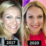 Lumispa Facial Treatment Device