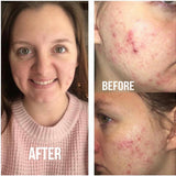 Lumispa Facial Treatment Device