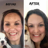 Lumispa Facial Treatment Device
