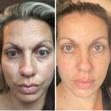 Lumispa Facial Treatment Device