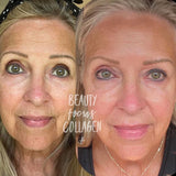 Beauty Focus™ Collagen+ Subscription