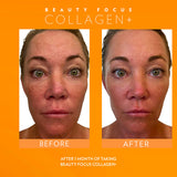 Beauty Focus™ Collagen+ Subscription