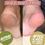Epoch® Sole Solution® Foot Treatment