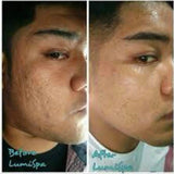 Lumispa Facial Treatment Device